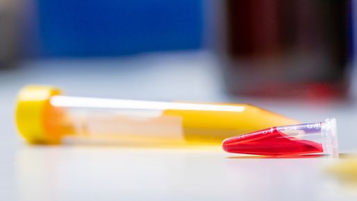 Two pipettes with red and yellow liquid 